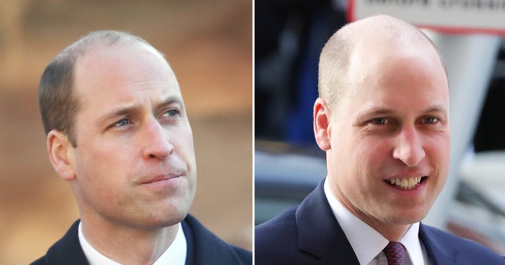Prince William is sexiest baldie of 2023