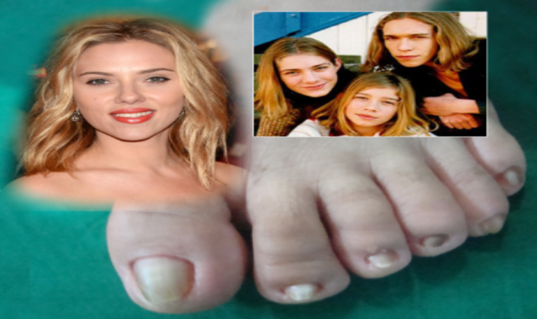 Toe-tally confused: Scarlett Johansson and Hanson tangle over surgery slot