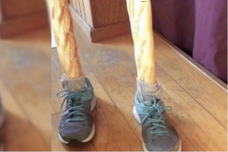 Crumbs! Prosthetic bread-legged ex Squaddie is marathon hero